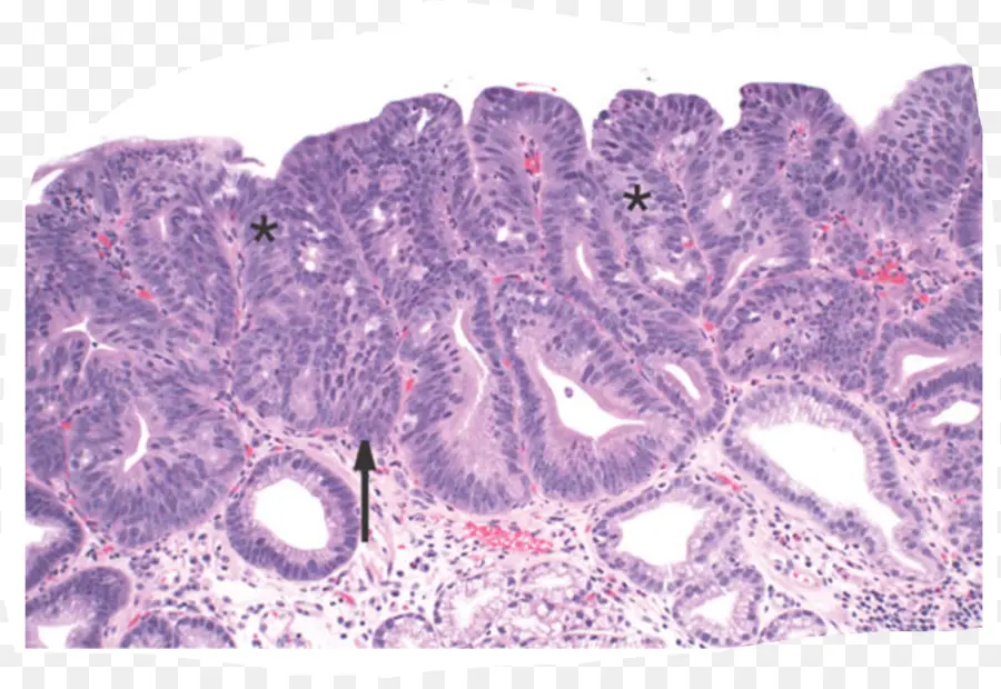 Slide De Histologia，Tecido PNG