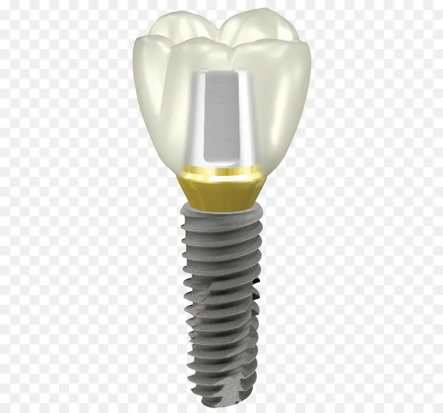 Implante Dentário，Dente PNG