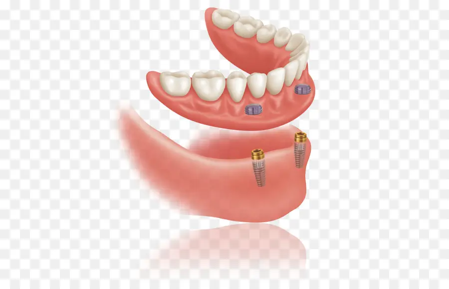 Dentaduras，Dentes PNG