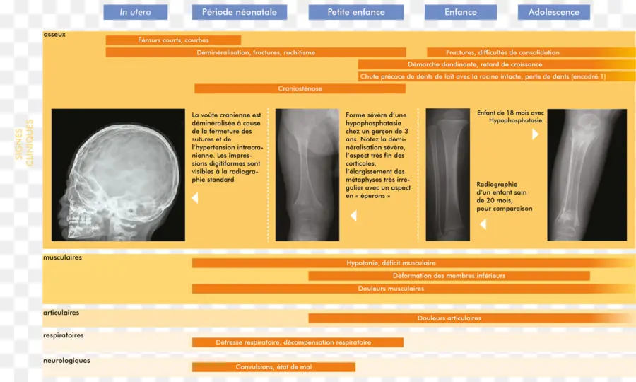 Imagens De Raios X，Radiografia PNG