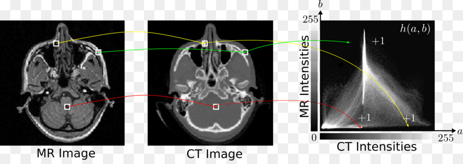 Imagens Médicas，Radiologia PNG