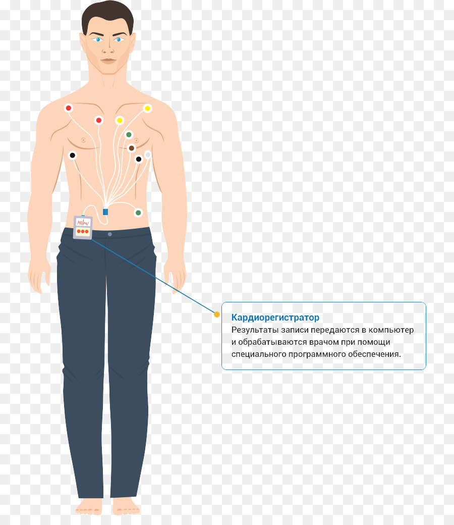 Monitor Holter，A Hipertensão PNG