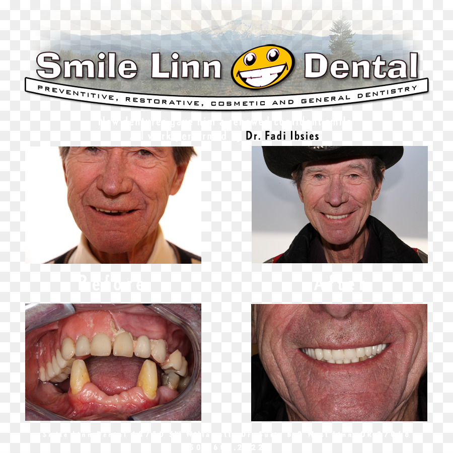 Sorriso Linn Dental Ibsies Fadi B Dmd，Dentist PNG