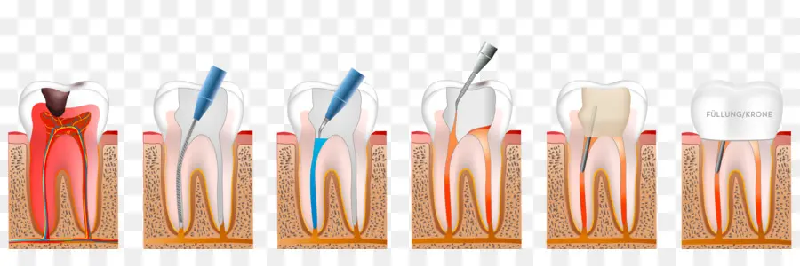 Diagrama De Dente，Dental PNG