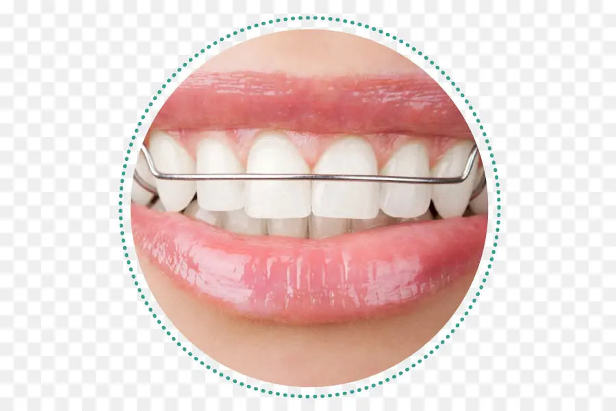 Ortodontia，Aparelhos Dentários PNG