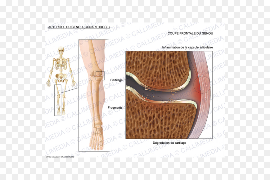 Do Ombro，Ligamento Colateral Fibular PNG