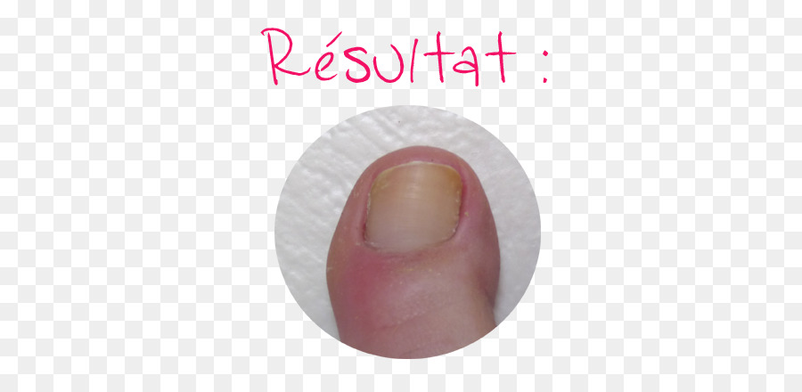 Nail，Pé PNG