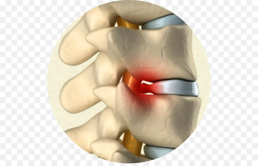 A Dor Na Coluna Vertebral，Quiropraxia PNG