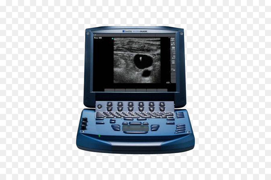 Acuson，A Ultra Sonografia PNG