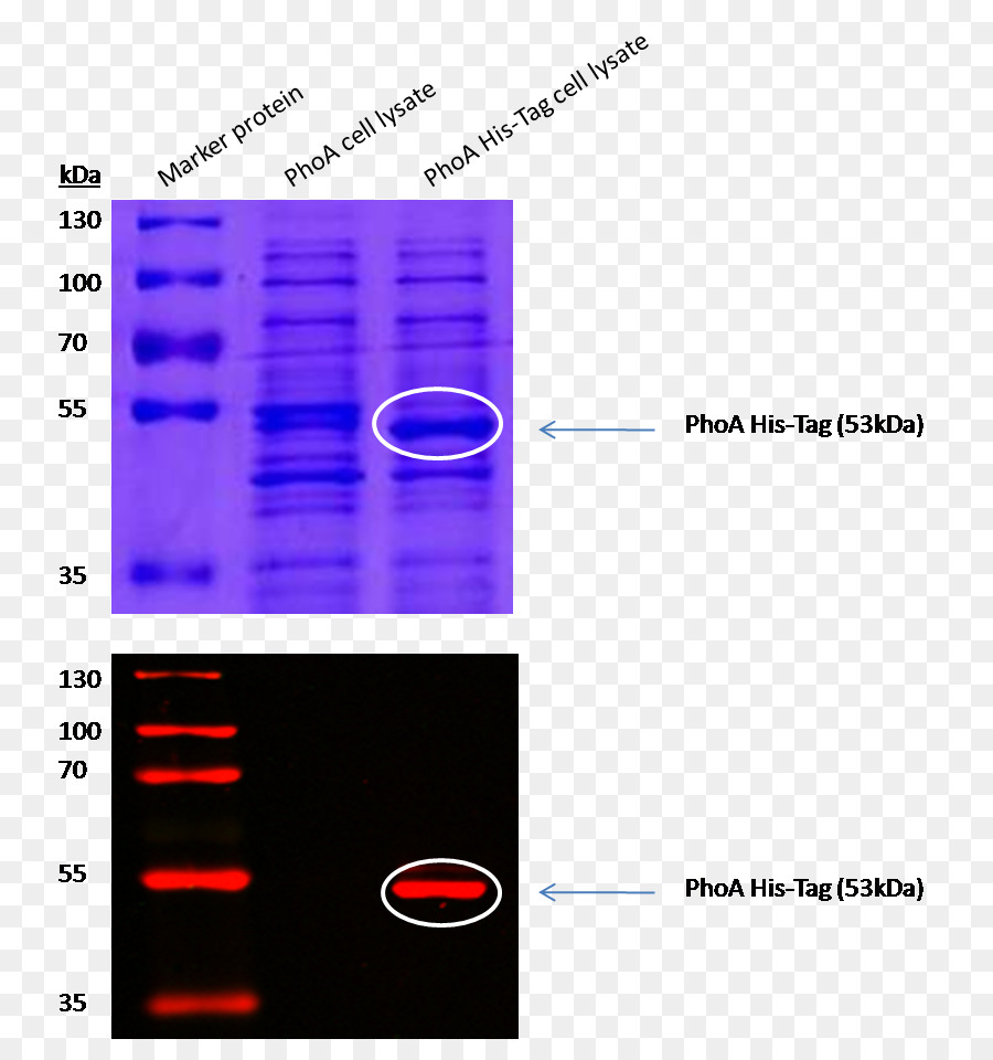 Gel Proteico，Eletroforese PNG