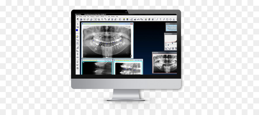 Radiografias Dentárias，Computador PNG