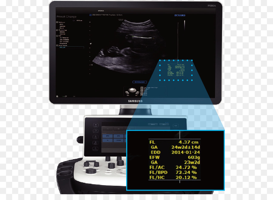 Ultra Som，A Ultra Sonografia PNG