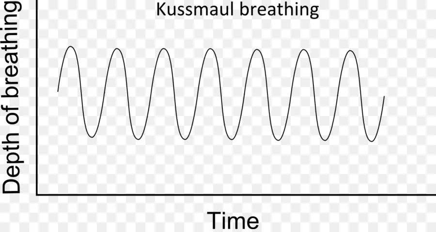 Gráfico De Respiração，Kussmaul PNG