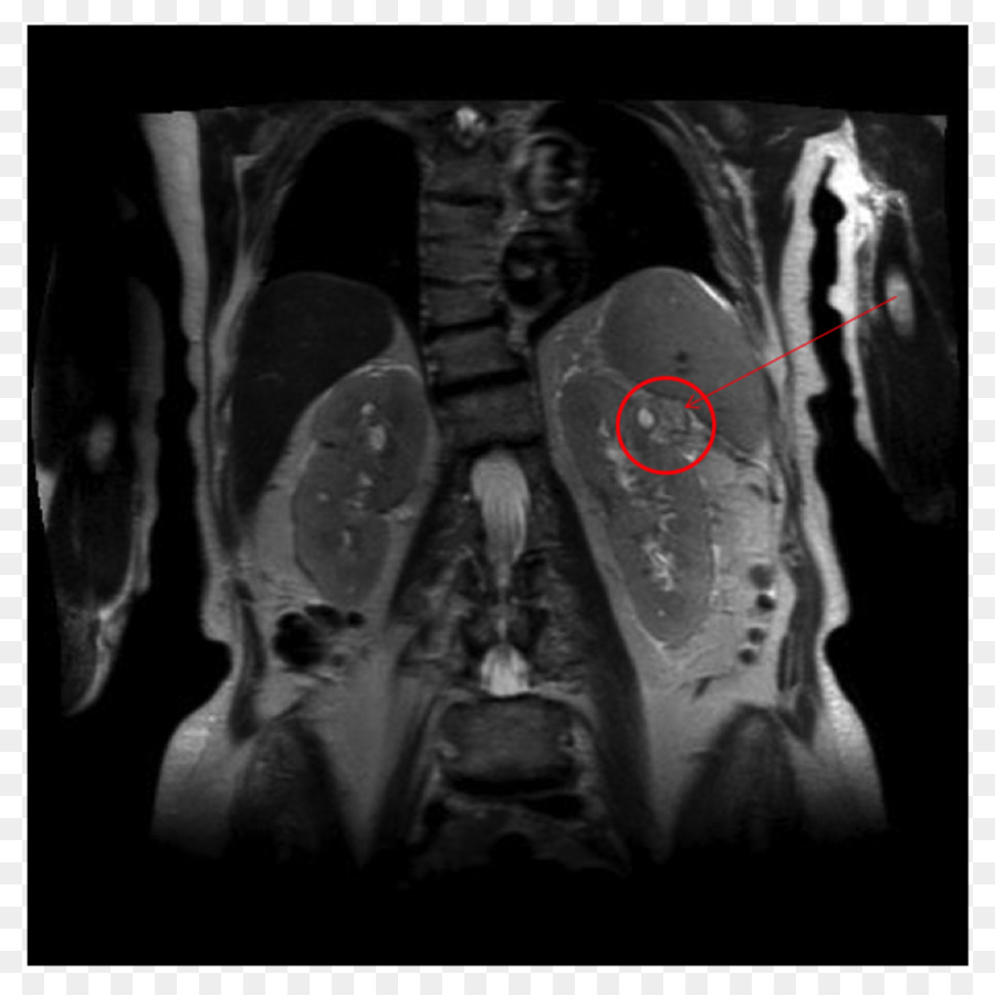 Imagens Médicas，Radiologia PNG