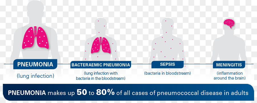 Infográfico Sobre Pneumonia，Pneumonia PNG