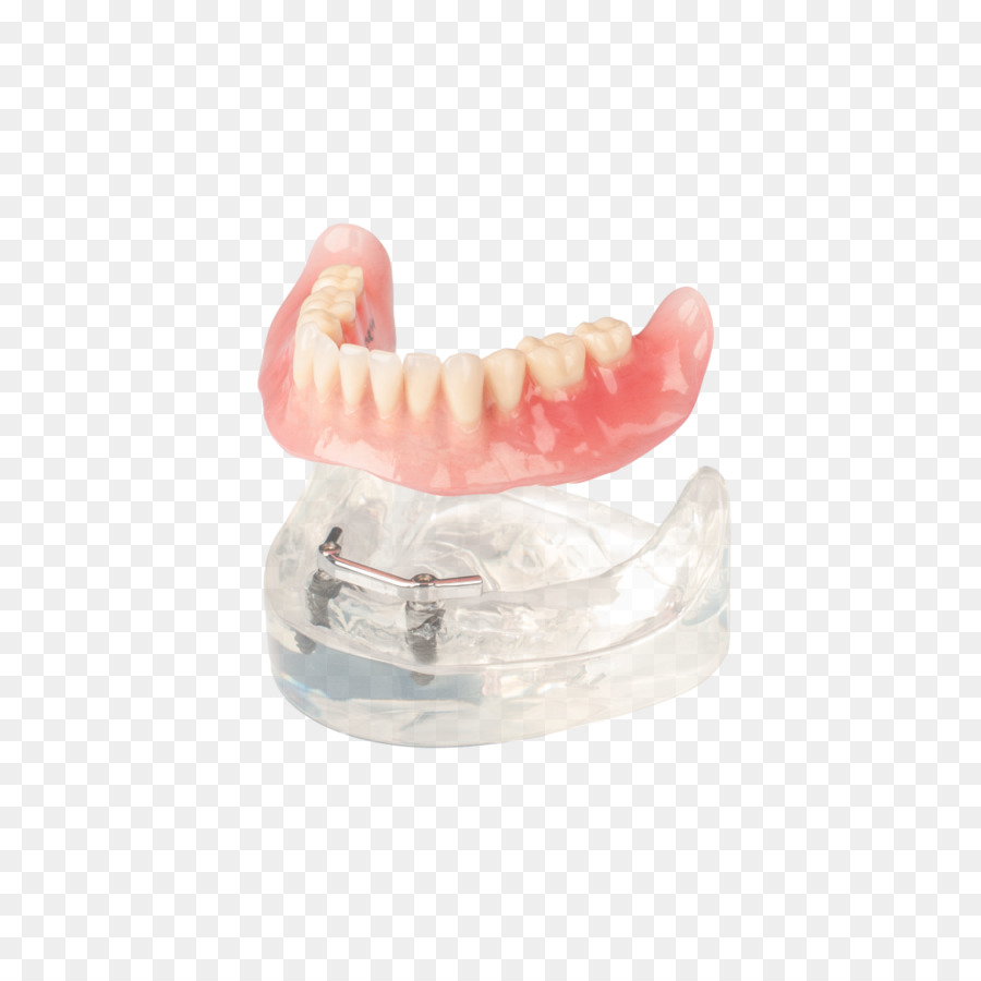 Dentaduras，Dente PNG