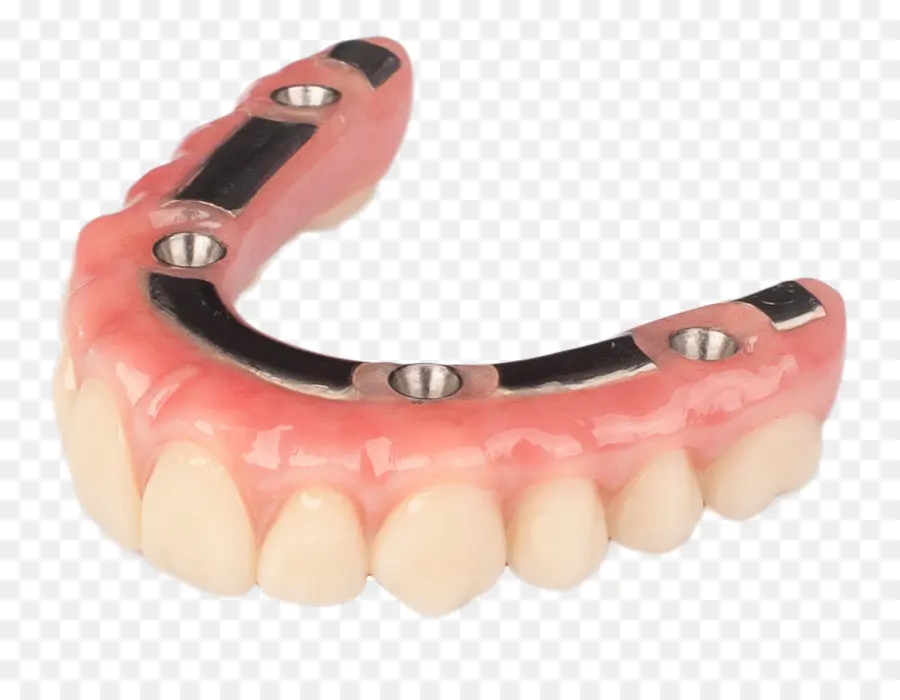 Prótese Dentária，Dentes PNG