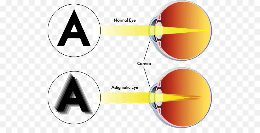 Olho Astigmático，Visão PNG