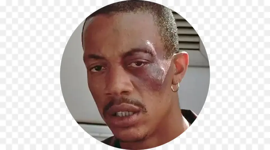 Homem Ferido，Hematoma PNG