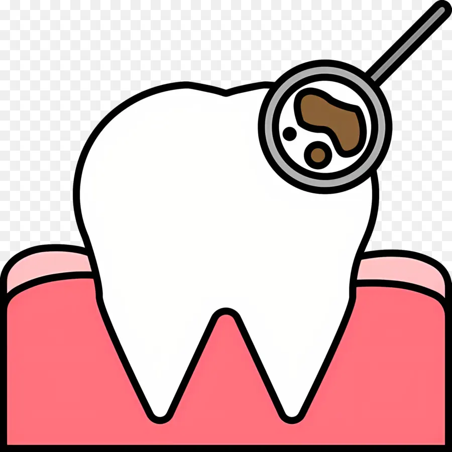 Verificação Dentária，Dente Com Cárie PNG